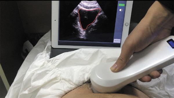 BLD-US-Bladder-ultrasound-scanner-Uforya-medical-application