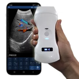 CD3-USono Color Doppler 3 in 1 Ultrasound Scanner smartphone wifi scan results