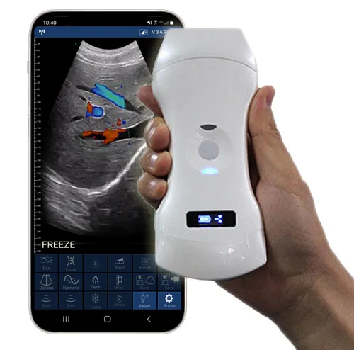 CD3-USono Color Doppler 3 in 1 Ultrasound Scanner smartphone wifi scan results